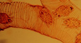Endoparassita che vive nelle trachee (1° paio toraciche) delle api adulte suggendo l’emolinfa